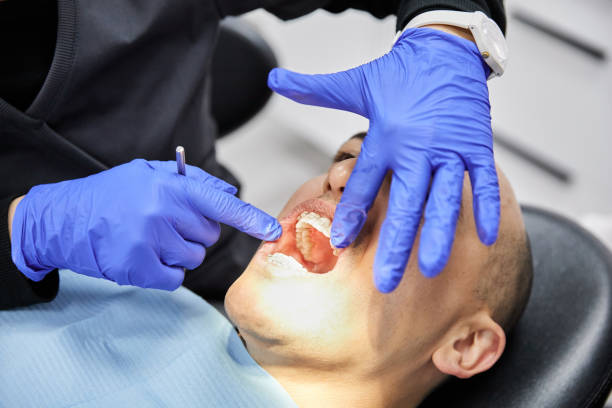 Best Emergency Wisdom Teeth Removal in Brillion, WI