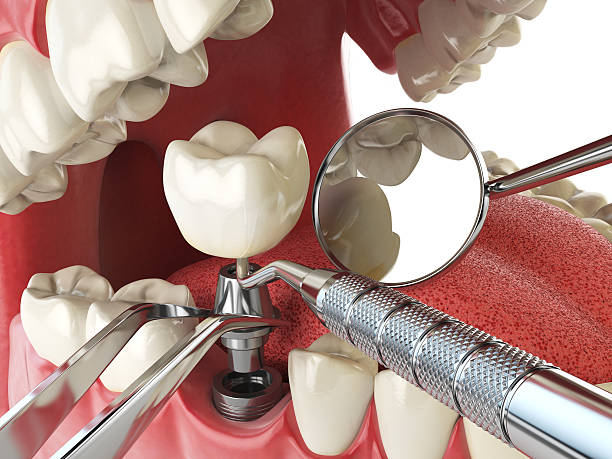 Best Emergency Dental Care for Broken or Chipped Teeth in Brillion, WI